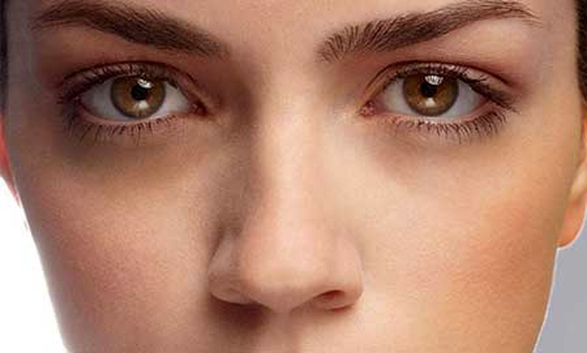 پنج راه حل برای رفع تیرگی اطراف چشم