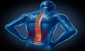 ۳ نکته اساسی درباره «دیسک کمر» که قبل از کمردرد باید بدانید