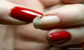 راههای جلوگیری از شکستن ناخن