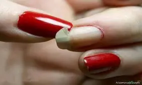 راههای جلوگیری از شکستن ناخن