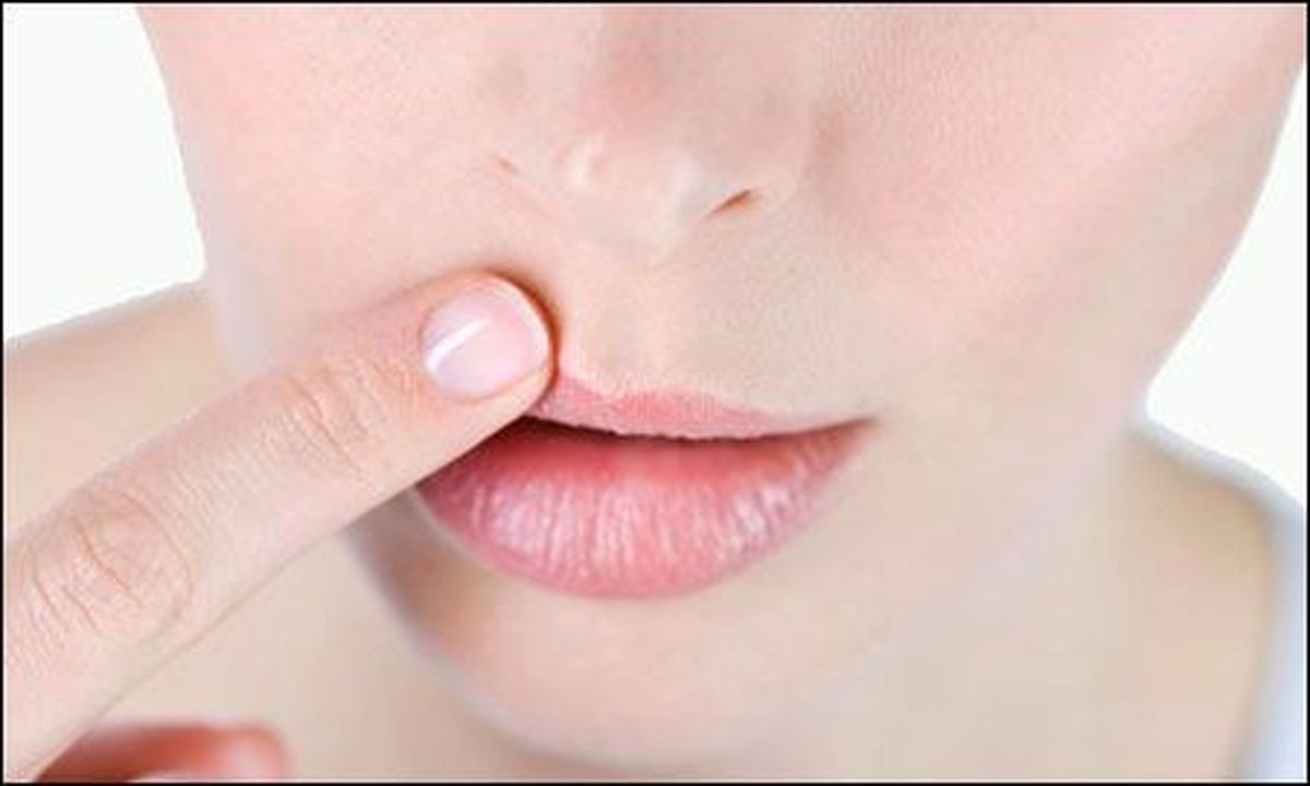 سریعترین درمانهای گیاهی تبخال لب