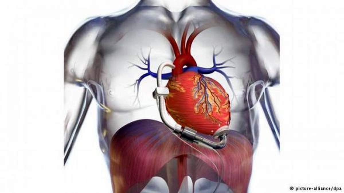 مرگ و میر ناشی از نارسایی قلبی در زنان بیشتر است