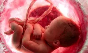 سقط جنین و نشانه های آن