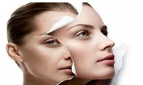 پیری زودرس پوست و عواملهای آن