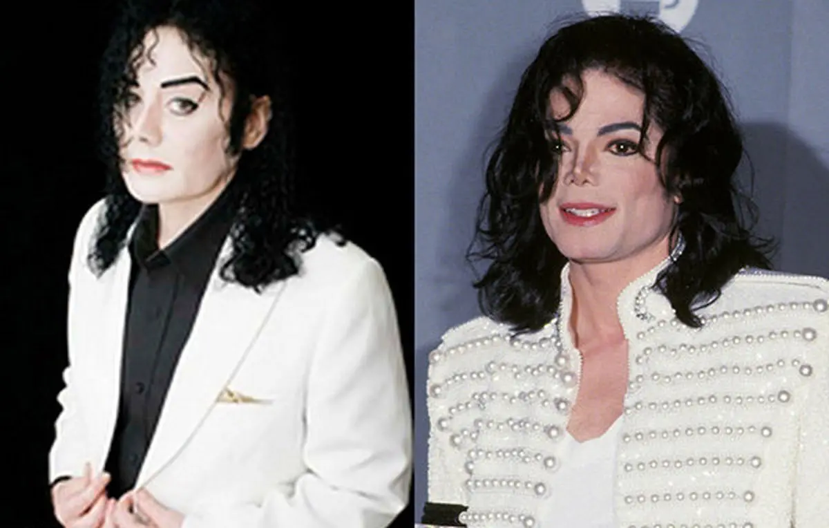 عجیب ترین و مضحک ترین جراحی های زیبایی