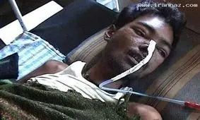 کشف عجیب 431 سکه در معده یک هندی!!!