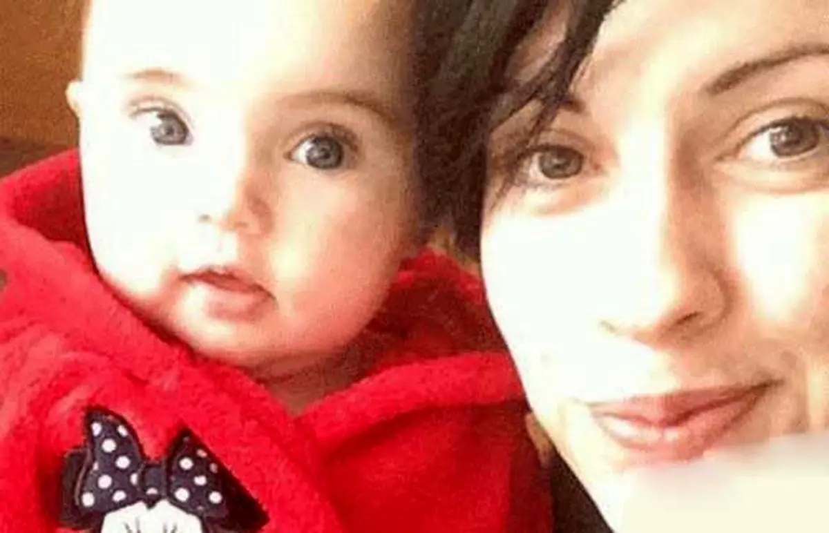 عادت این زن 23 ساله‌ به خوردن موهایش