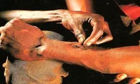 مورچه های حیرت انگیز که جراحی می کنند!!