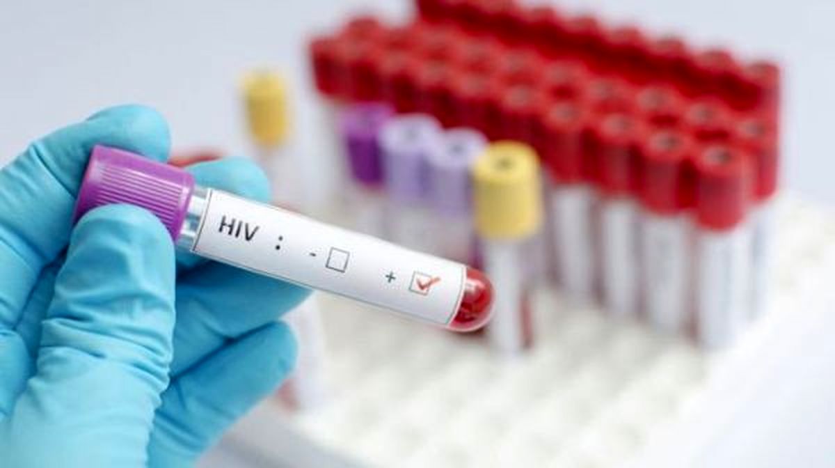 کاهش سرعت مهار اچ‌آی‌وی در جهان