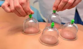 افراد بالای 60 سال حجامت نکنند