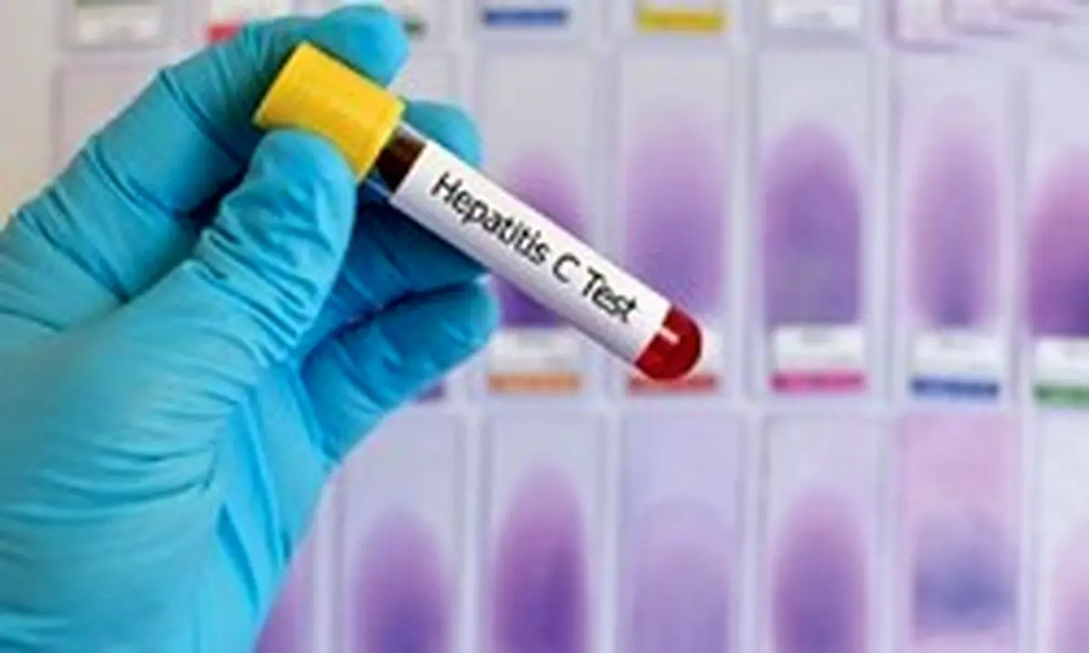 خطر در کمین ۱۷۶ هزار بیمار مبتلا به هپاتیت c/ وقتی مسئولان خواب‌اند