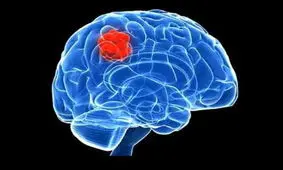 سی تی اسکن موجب افزایش ریسک تومور مغزی می‌شود