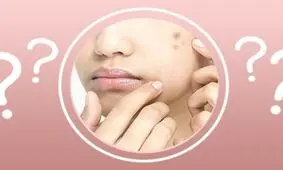 ( جوش صورت ) شما به دلیل استفاده از این وسیله است!!