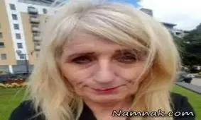 جراحی زیبایی ، صورت پیرزن 57 ساله را زیر و رو کرد + عکس