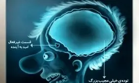 اسکن مغزی یک ایرانی در شرایط کنونی!