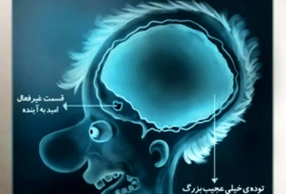 اسکن مغزی یک ایرانی در شرایط کنونی!