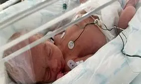 تصویر نوزادی که عضله شکم ندارد دانشمندان را شوکه کرد! + عکس