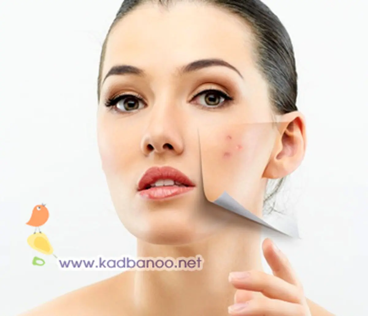 درمان جوش های زیر پوستی در خانه