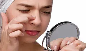 جلوگیری از جوش صورت در تابستان با دانستن چند نکته!