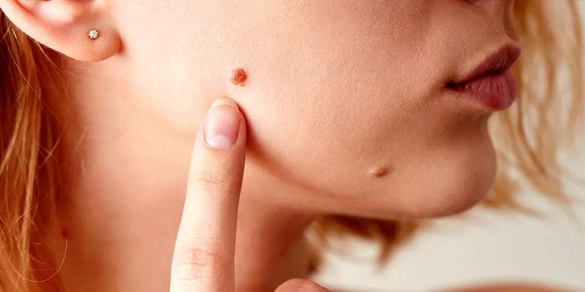 ۱۰ نشانه بیماری که در صورت ظاهر می شود را بشناسید