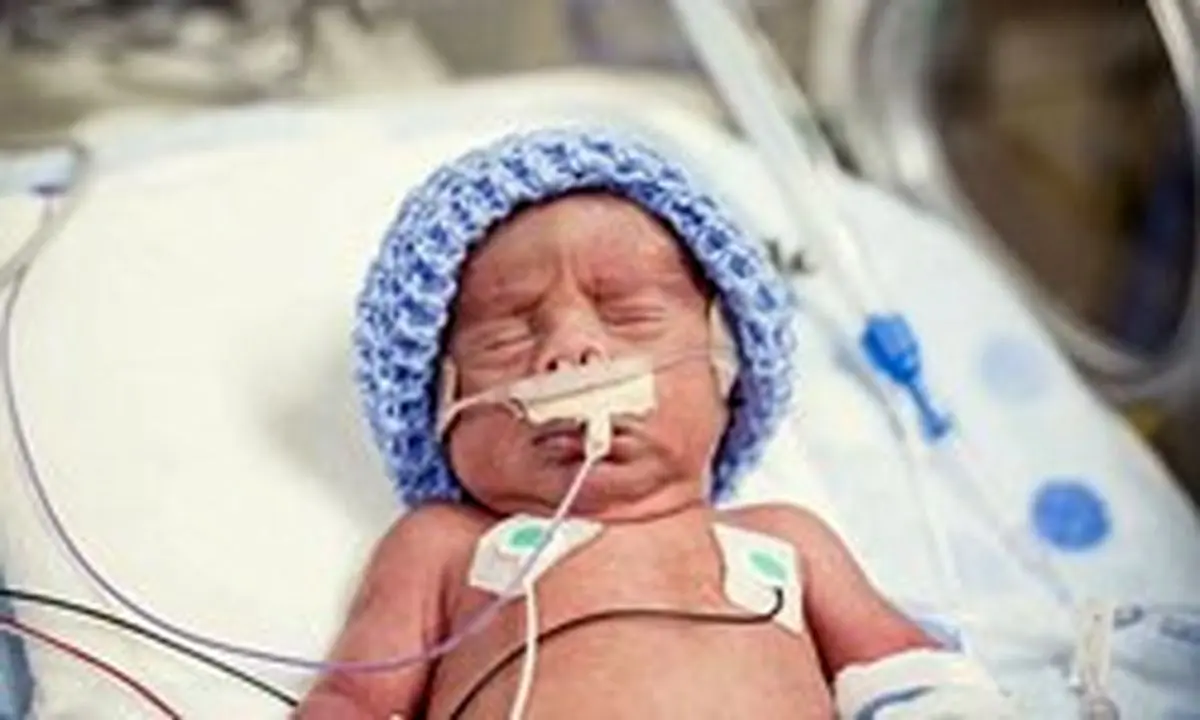 آمریکا؛ خطرناک‌ترین کشور توسعه یافته برای وضع حمل