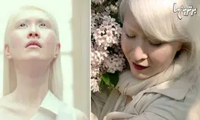 مدل‌های شجاعی که استاندارد‌های زیبایی را تغییر دادند