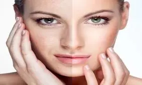 چگونه لکه های سیاه پوستی را از بین ببریم؟