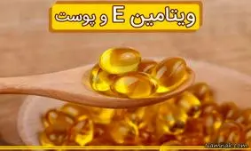 تاثیر فوق العاده ویتامین E در مبارزه با چین و چروک