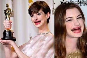 عکس های خنده دار از زنان زیبای هالیوود بدون دندان!