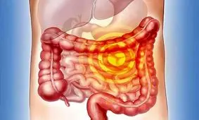 سبزیجاتی که از ابتلا به سرطان روده پیشگیری می‌کنند