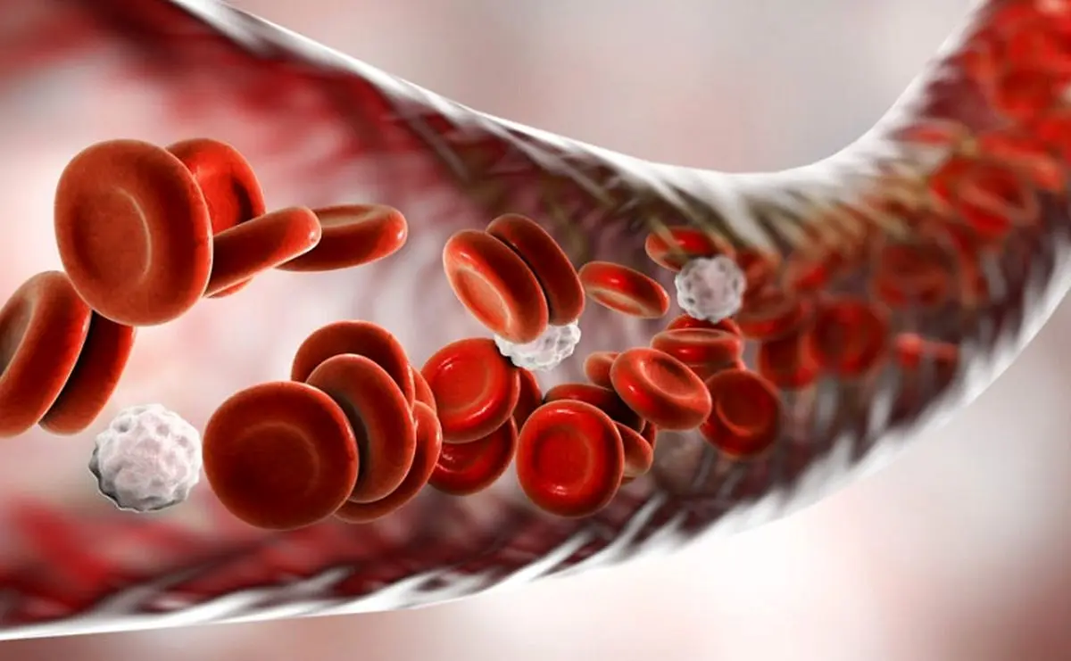 ضرورت درمان فوری عفونت خون