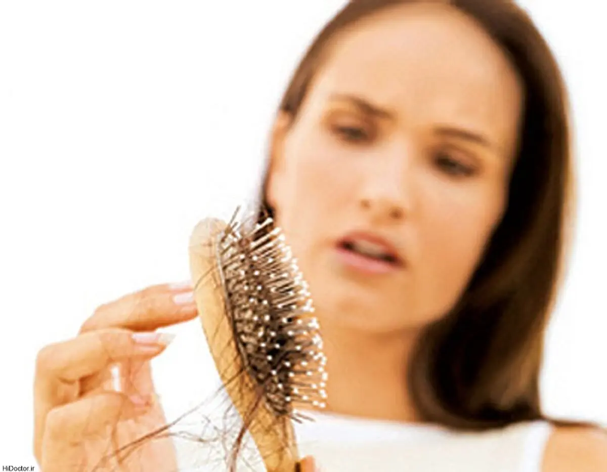 کدام ریزش مو برگشت‌پذیر است؟