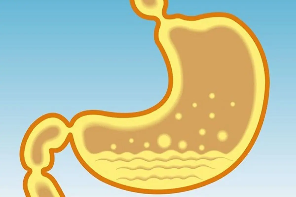 اسید معده چه تاثیر بر سلامتی دارد؟