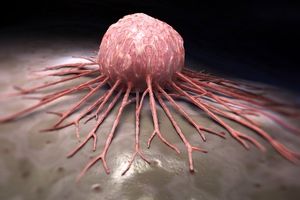راه‌های پیشگیری از ابتلا به سرطان پروستات را بشناسید