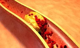 12 گزینه غذایی که از انسداد شریانها پیشگیری می کنند