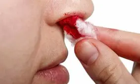 مشکلات بینی را جدی بگیرید