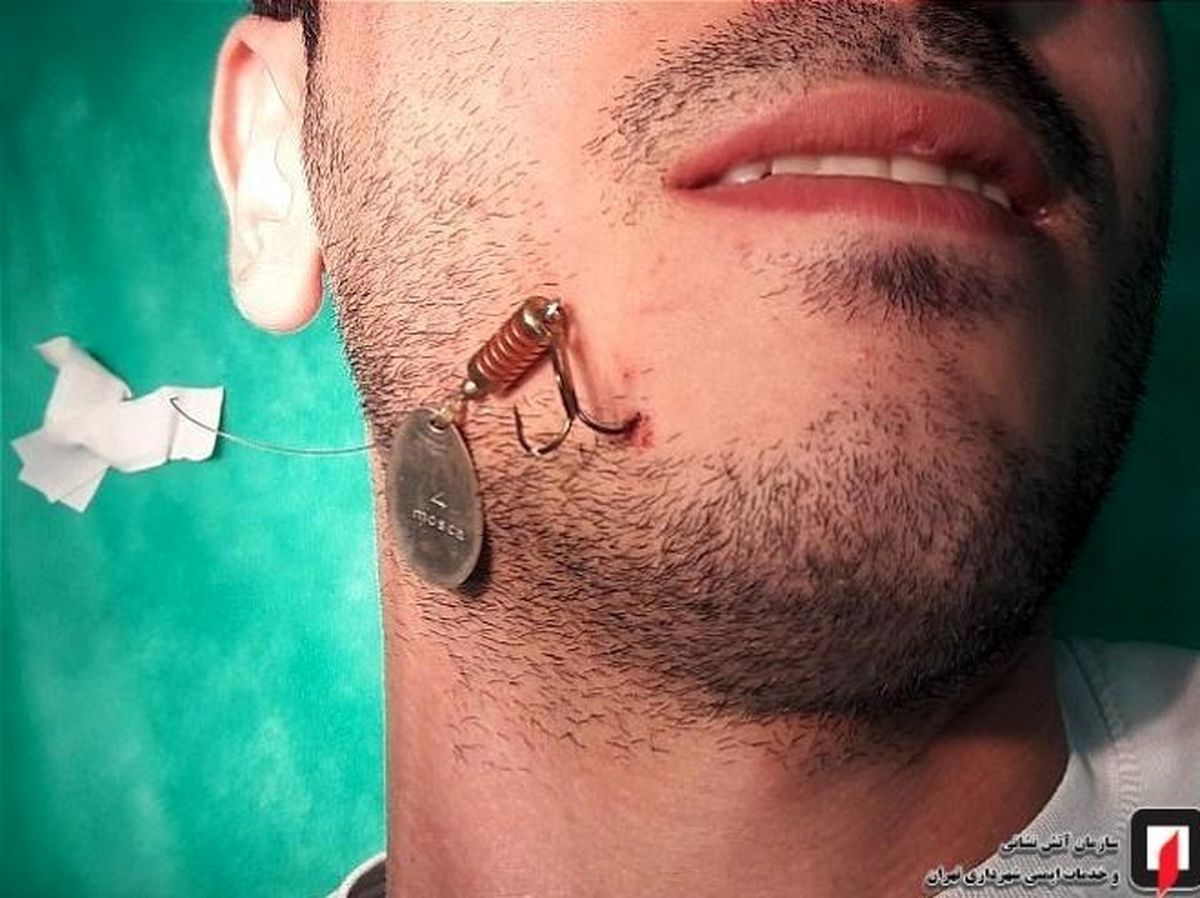 مرد ماهیگیر صورت خودش را صید کرد! + تصاویر