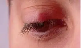 گل‌مژه را به هیچ وجه نترکانید