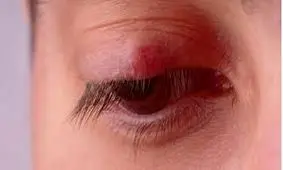 گل‌مژه را به هیچ وجه نترکانید