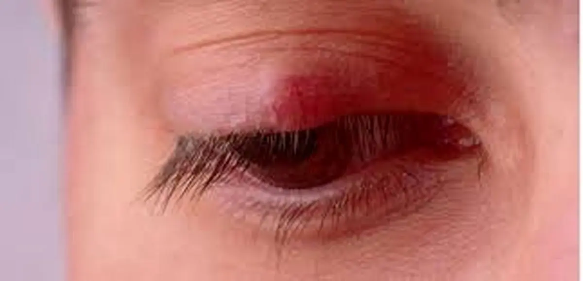 گل‌مژه را به هیچ وجه نترکانید