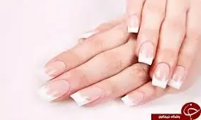 ناخن ها درباره سلامت شما چه می گویند؟