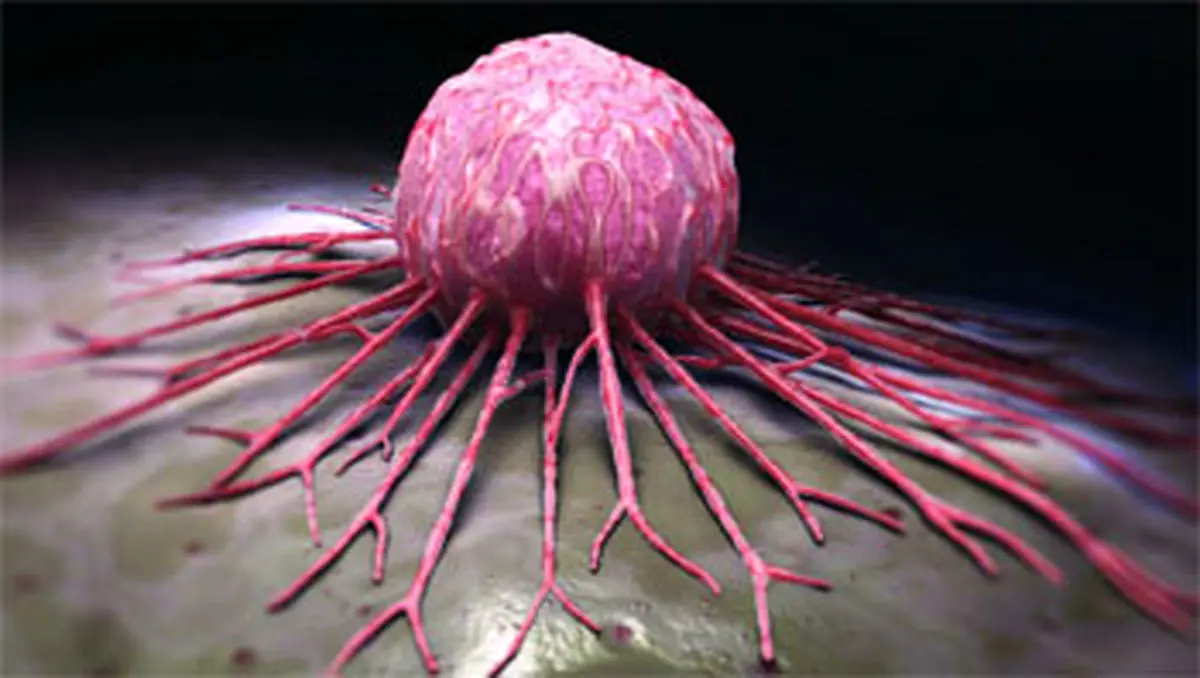 کدام شغل های جهان سرطان زا هستند؟