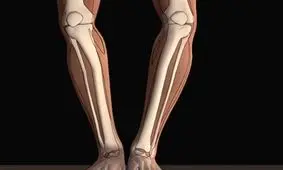 عارضه پای پرانتزی؛ از ابتلا تا درمان عارضه