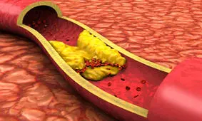 برای کاهش چربی خون چه بخوریم ؟