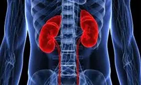 قاتل کلیه‌ها را بشناسید