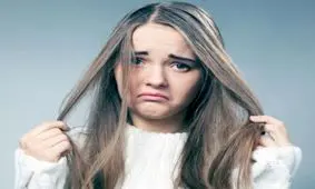 علت اصلی چرب شدن موی سر و راههای کاهش آن