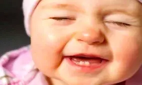 دلایل دندان قروچه در کودکان چیست؟