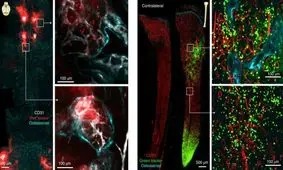 کانال‌های کوچک پنهان در مغز کشف شد+ عکس