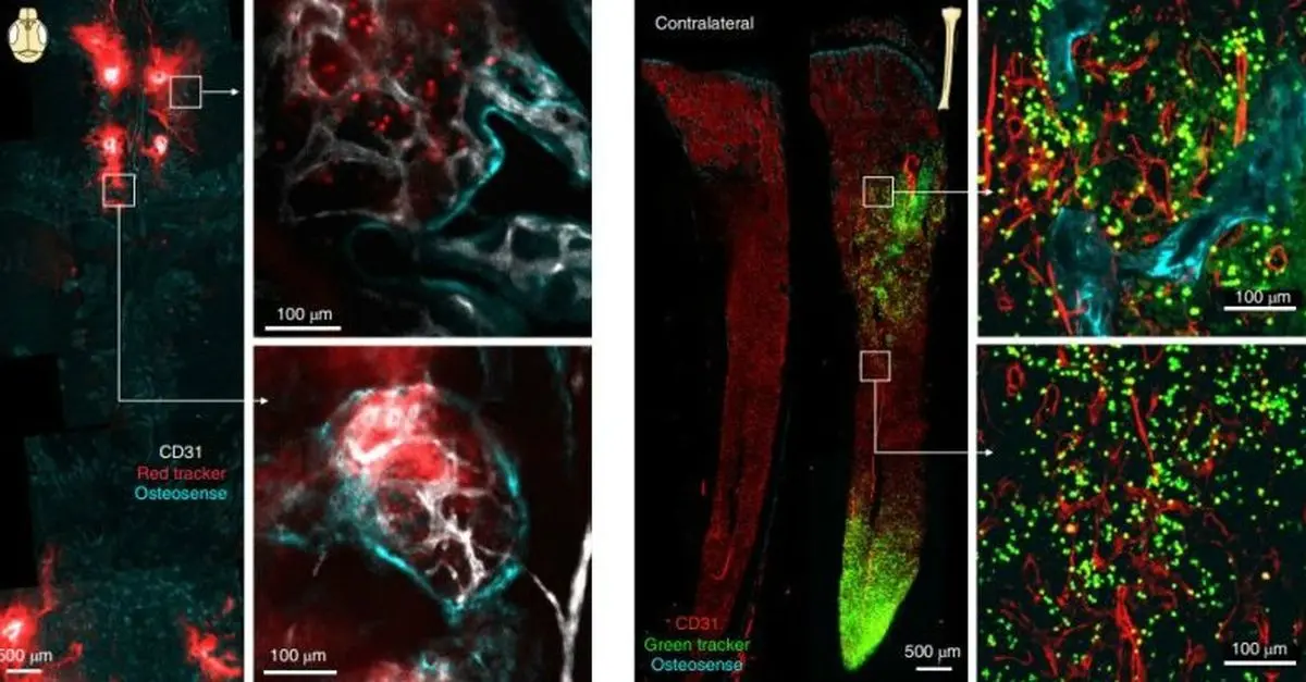 کانال‌های کوچک پنهان در مغز کشف شد+ عکس