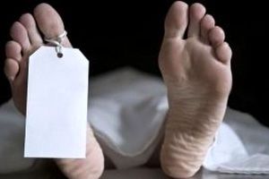 پایان مرگبار جراحی لاغری/ اتهام قتل غیرعمد برای پزشک جراح